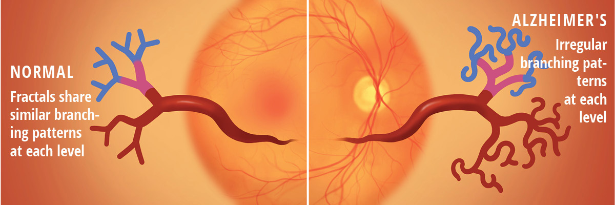 Illustration of the anatomy of the eye